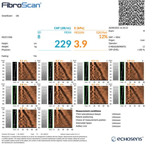 bad fibroscan results|Your Fibroscan results explained .